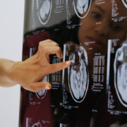 Banner Brain Health