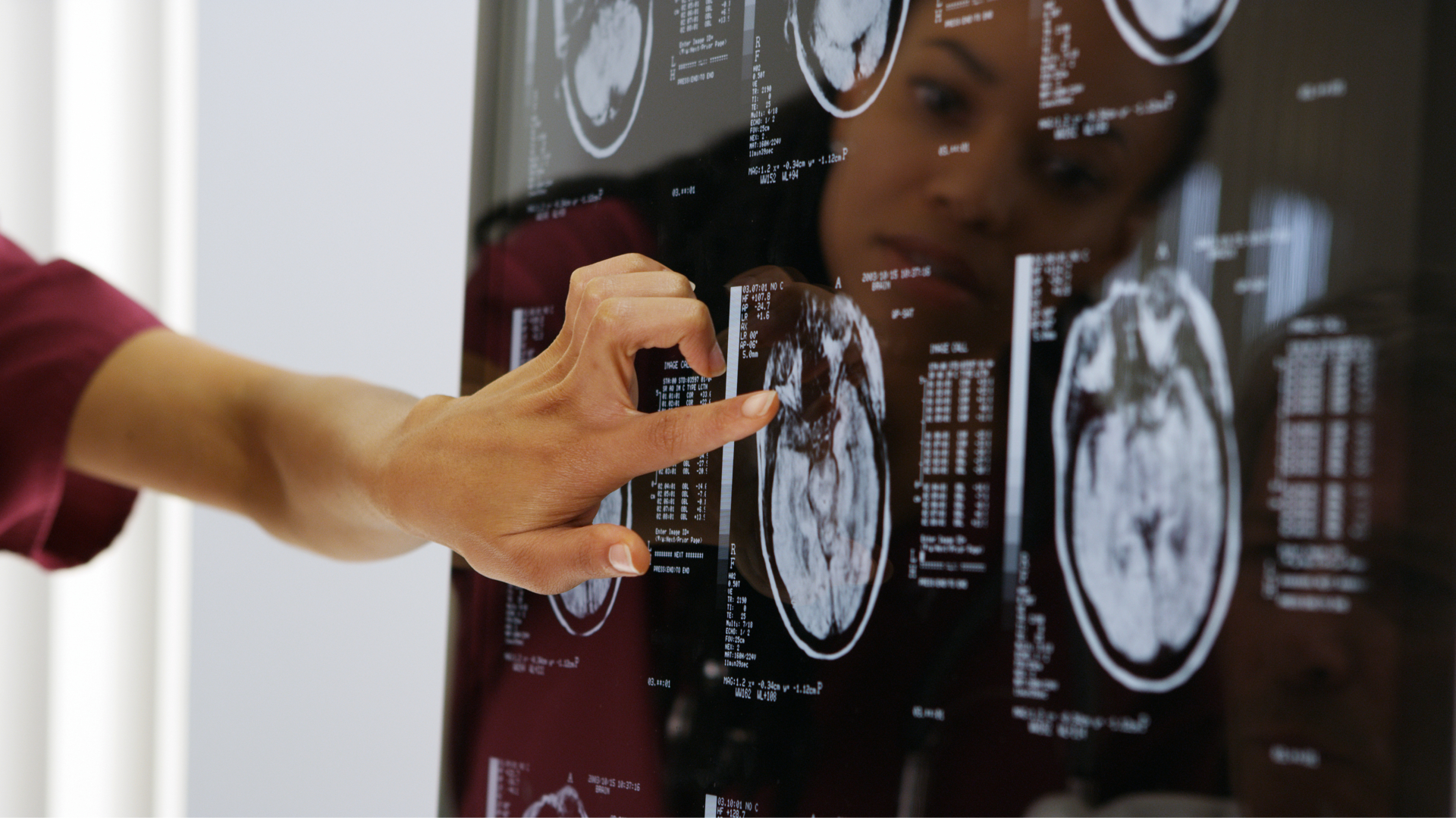 Banner Brain Health